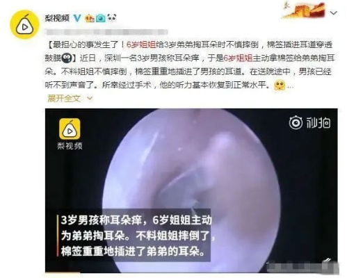 爸爸掏耳遭遇孩子撞击，意外耳膜脱落
